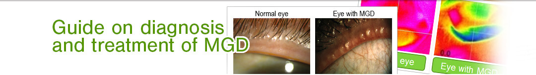 Guide on diagnosis and treatment of MGD