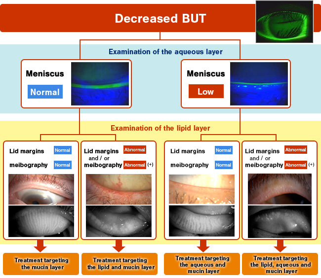 Fig. 5: Examination of the lipid layer for targeted treatment of dry eye