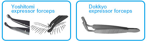 Various meibomian gland expressor forceps