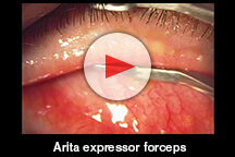 Arita expressor forceps 