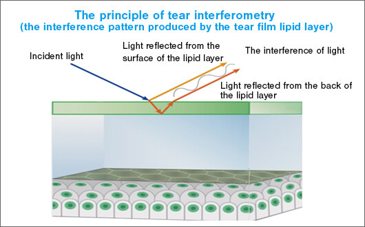 Fig. 2: Interference colors are produced by the different paths taken by light reflected by the surface of the tear film lipid layer and light reflected by the back of the lipid layer