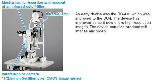 Fig. 1-a: Non-contact meibograph attached to a slit-lamp