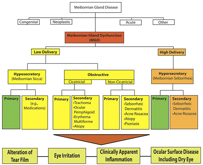 Fig .3 The new classification system proposed by the International Workshop on MGD distinguishes among the subgroups of MGD on the basis of the level of secretions and further subdivides those categories by potential consequences and manifestations. On the basis of these proposed classifications, obstructive MGD is the most pervasive.