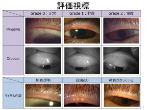 評価視標