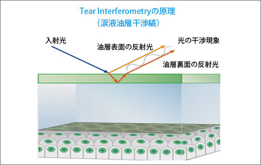 涙液油層表面からの反射光と裏面からの反射光との光路差によって干渉色が出現する(スライド提供：興和(株)※一部改編）