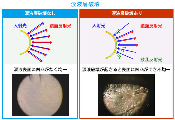 涙液層破壊(スライド提供：興和(株)※一部改編）