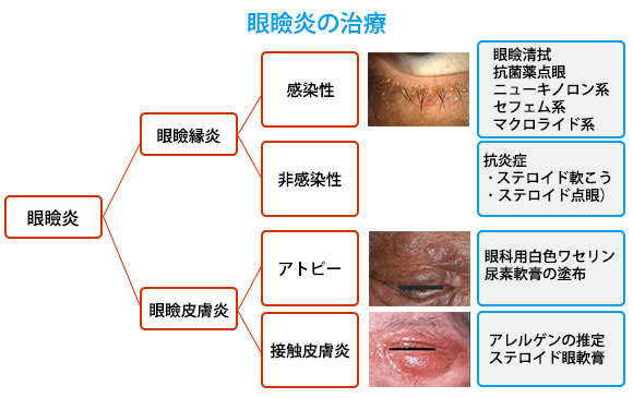 (図9)眼瞼縁の治療