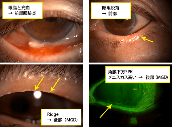 症例１