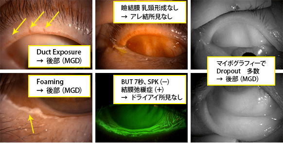 症例４