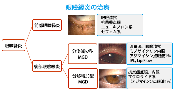 (図10)眼瞼縁炎の治療